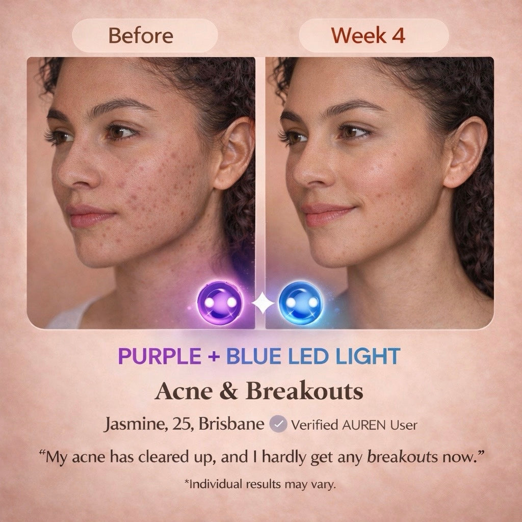 AUREN – Professional LED Therapy Mask